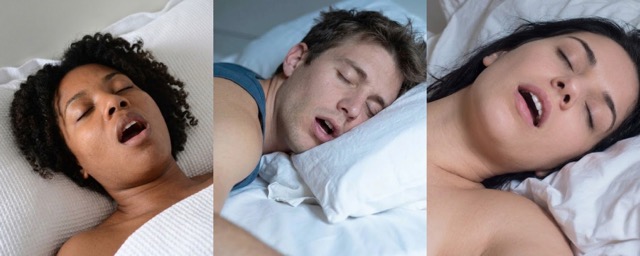 Mouth breathing during sleep