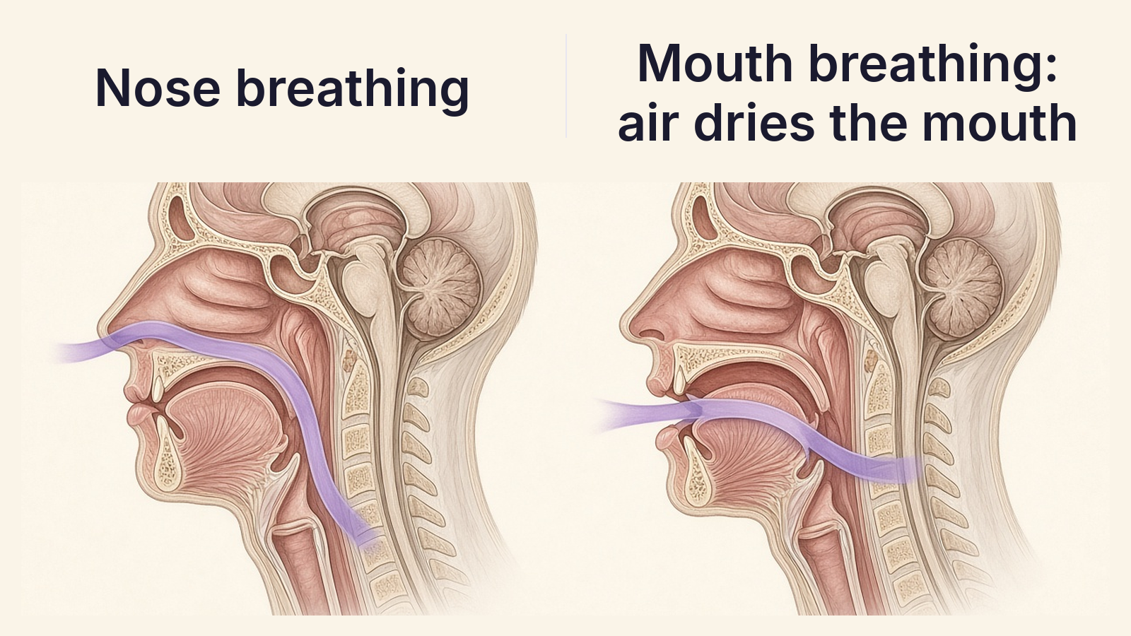 Diagram of nose breathing with the mouth closed beside mouth breathing, where air crosses the tongue and gums and dries the mouth